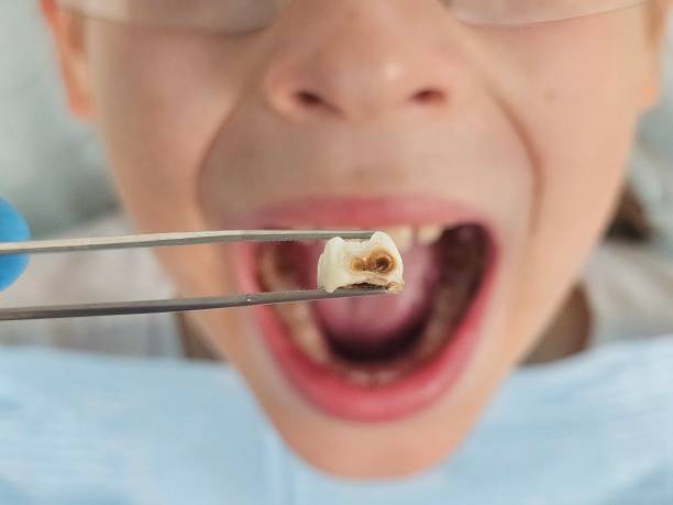 Best Emergency Dental Care for Trauma or Injury in Forsyth, MT